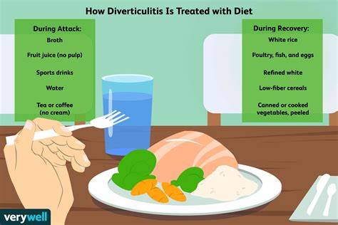Diverticulitis Surgery: Prep and Recovery