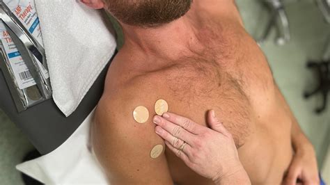 Can you pull muscle from coughing? - ANF