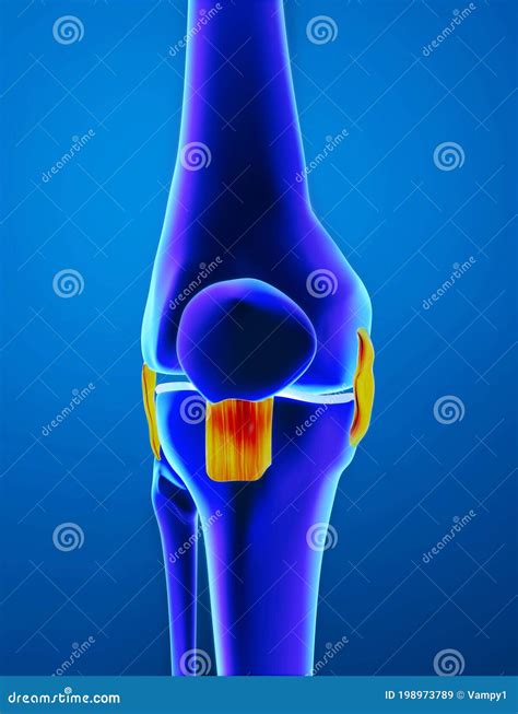 Inflammation, Sprained Knee Ligaments. Femur, Buckle and Patella Seen ...