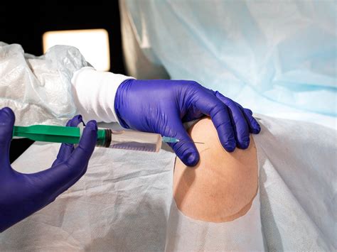 New Injection For Knees Viscosupplementation Knee Injection