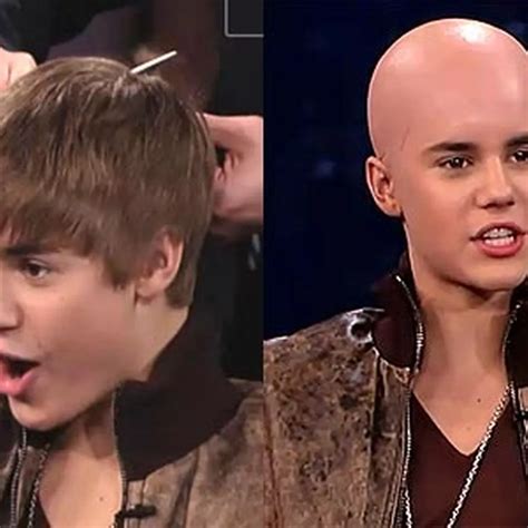 Justin Bieber Bald
