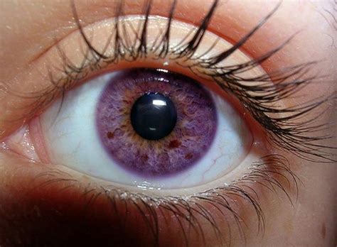 Rare Eyes