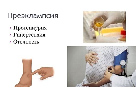Отеки при беременности: причины, чем лечить | ЭКО-блог
