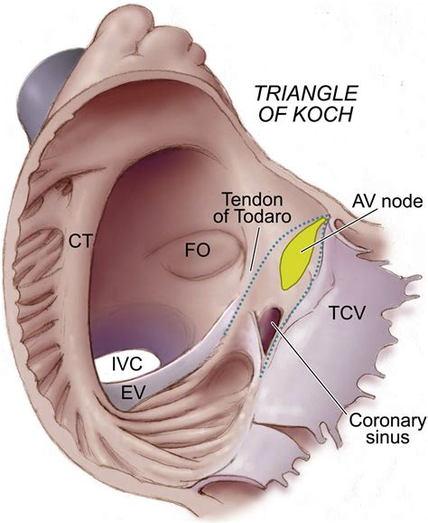 Anatomy and Pathology of the Cardiac Conduction System - Cardiology Clinics