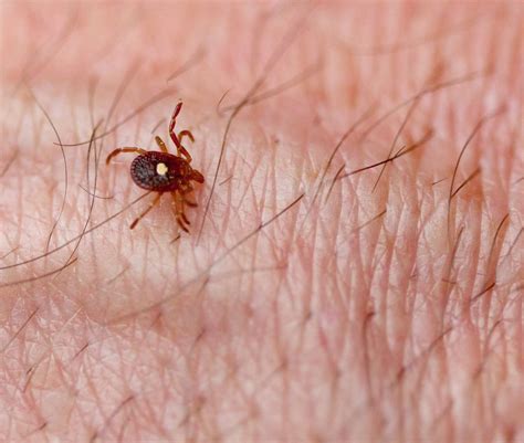 Lone Star Tick Bite: Diseases and Locations