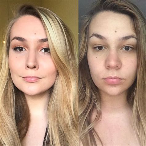 Pregnant Swollen Face