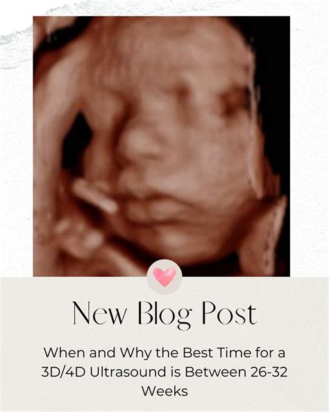 When and Why the Best Time for a 3D/4D Ultrasound is Between 26-32 Weeks - Baby Studio 4D