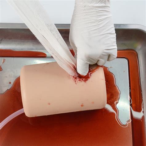 Differences between wound evisceration vs dehiscence - MEDTACEDU