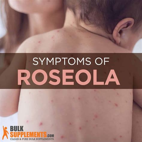 Roseola Rash Legs