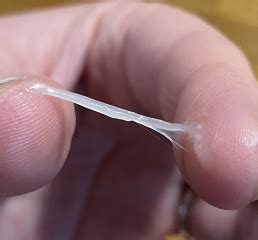 Jelly discharge 13 weeks pregnant - picture | Mumsnet