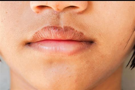 Can Pregnancy Make My Lips Dry | Lipstutorial.org