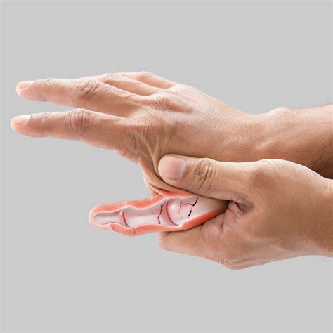 Thumb Joint Pain After 50? Causes, Home Treatment & How a CMC Brace Helps – KDbrace