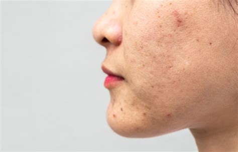 A Complete Guide To Clearing The Different Types Of Clogged, 44% OFF