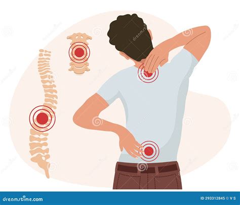 Cervical Arthritis Back Pain at Mercedes Jackson blog