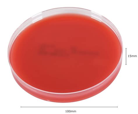 Hardy Diagnostics 5% Sheep Blood Agar Plate with Enhanced Hemolysis in ...