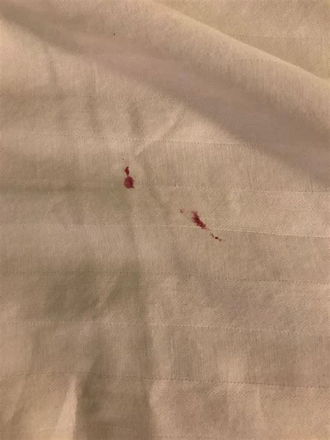 BEST WESTERN ABILENE INN & SUITES - Prices & Hotel Reviews (TX)