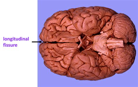 Brain Anatomy – 375-Human Physiology in Health and Disease (PBIO 375)