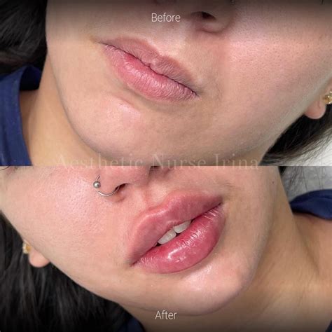 Cosmetic Treatments Before and After Gallery