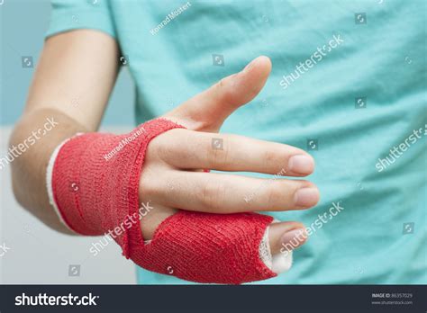 Broken Finger Cast