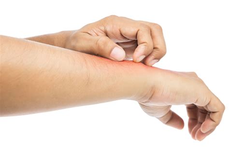 Ácaros En La Piel » Características, Riesgos Y Prevención