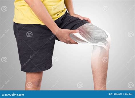 X-ray thigh muscle pain stock image. Image of exercise - 314964687