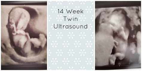 Pregnancy Update: 14 Weeks Pregnant with Twins