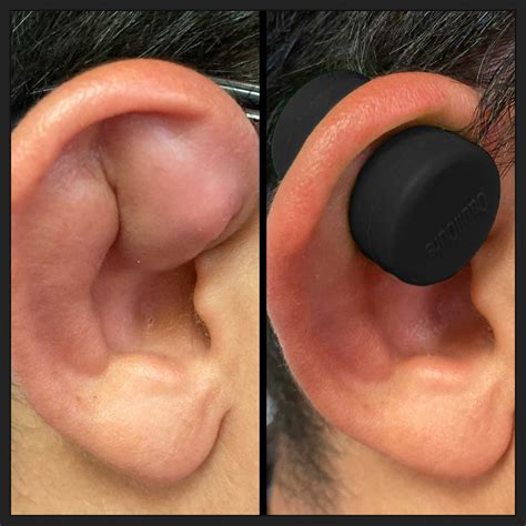 How to use Caulicure for the Treatment and Prevention of Cauliflower E