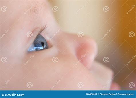 A Baby With Eyes Full Of Rheum, Produced By Conjunctivitis, Inflammation Of The Conjunctiva Of ...