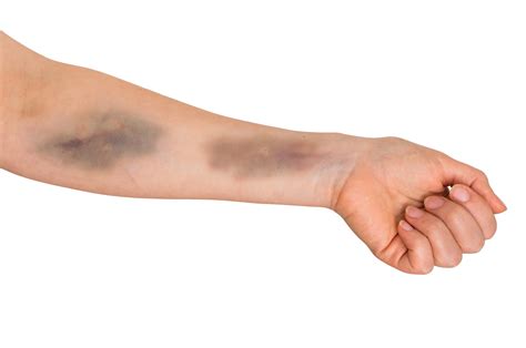 How To Draw Hand Veins