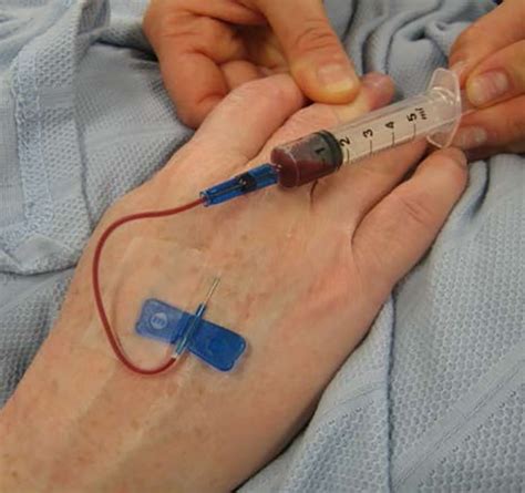 Butterfly Venipuncture, 50% OFF | www.elevate.in