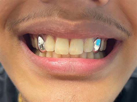 2x Sterling Silver 925 Grillz Any Teeth FREE Worldwide Shipping! - Etsy | Silver grillz teeth ...