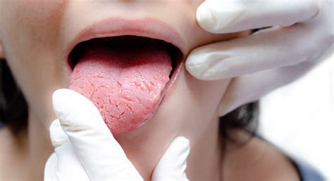 What Is Glossitis? Symptoms, Causes & Care Tips | Oral-B UK