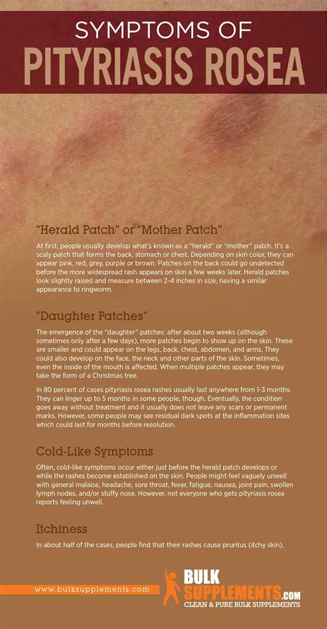 Pityriasis rosea symptoms causes treatment – Artofit