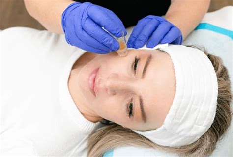 PRP Facial (Platelet-Rich Plasma Facial) or Vampire Facial