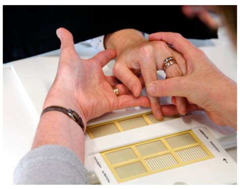 Characterizing Touch Discrimination Impairment from Pooled Stroke ...