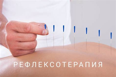 Новое направление — рефлексотерапия