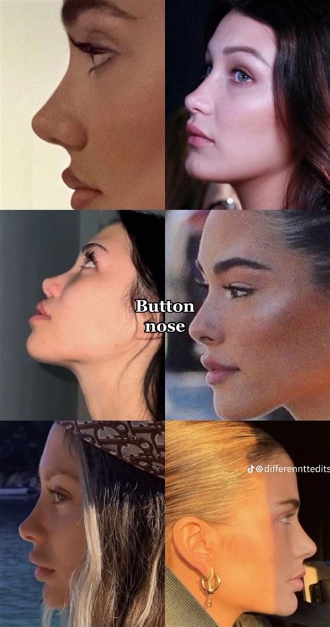 Pin by nanna on style | Rhinoplasty nose jobs, Pretty nose, Nose job