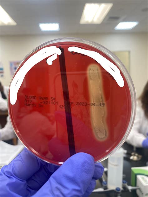Blood Agar Alpha Beta Gamma
