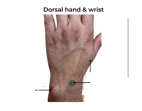 Dorsal hand and wrist Quiz
