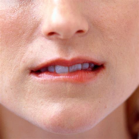 Canker Sores Corner Of Mouth