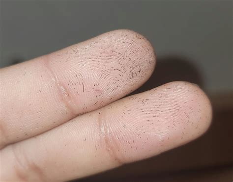 Was shaving my head and I noticed the hairs settled into the groves of ...