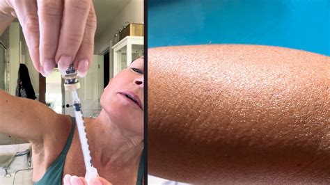 Melanotan 1 vs. 2: My Summer Journey & Real Results - Natural Kaos