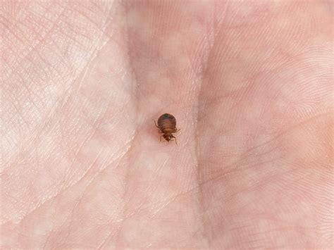 Understanding Baby Fleas: A Comprehensive Guide