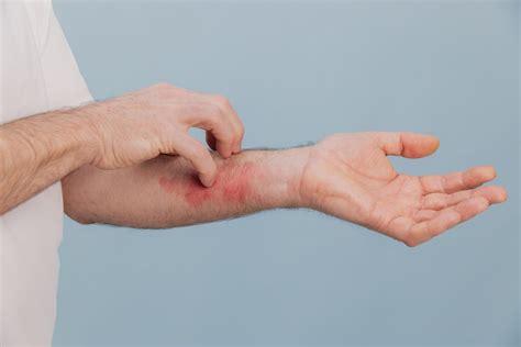 Minor Cuts: 5 Tips to Stop Bleeding