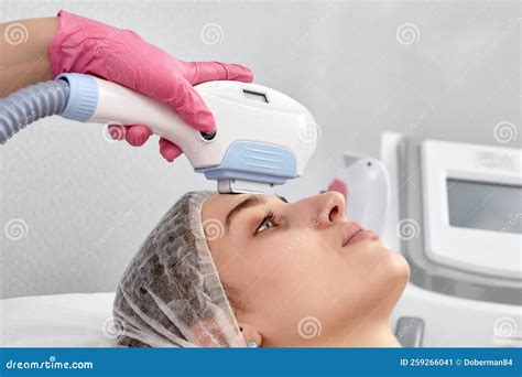 Laser Epilation Face