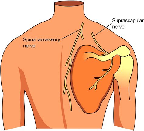 Dorsal Scapular Nerve Entrapment: A Guide to Symptoms, Diagnosis, and ...