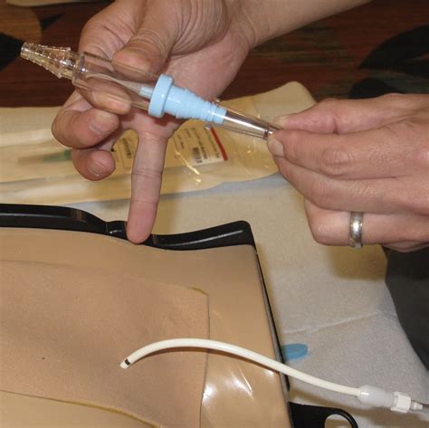 Pigtail Catheter Placement