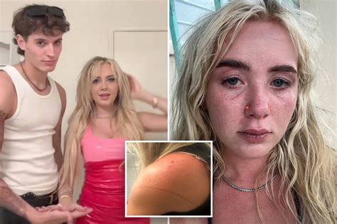Influencer arrested for domestic assault as his TikTok star ex details ...
