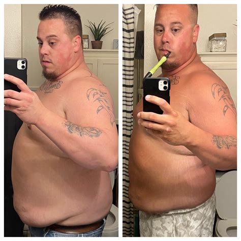 310 Pounds Before And After Michael Oliak Center For Weight Loss