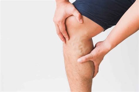 Blood Clot in Arm: Causes, Symptoms & Treatment